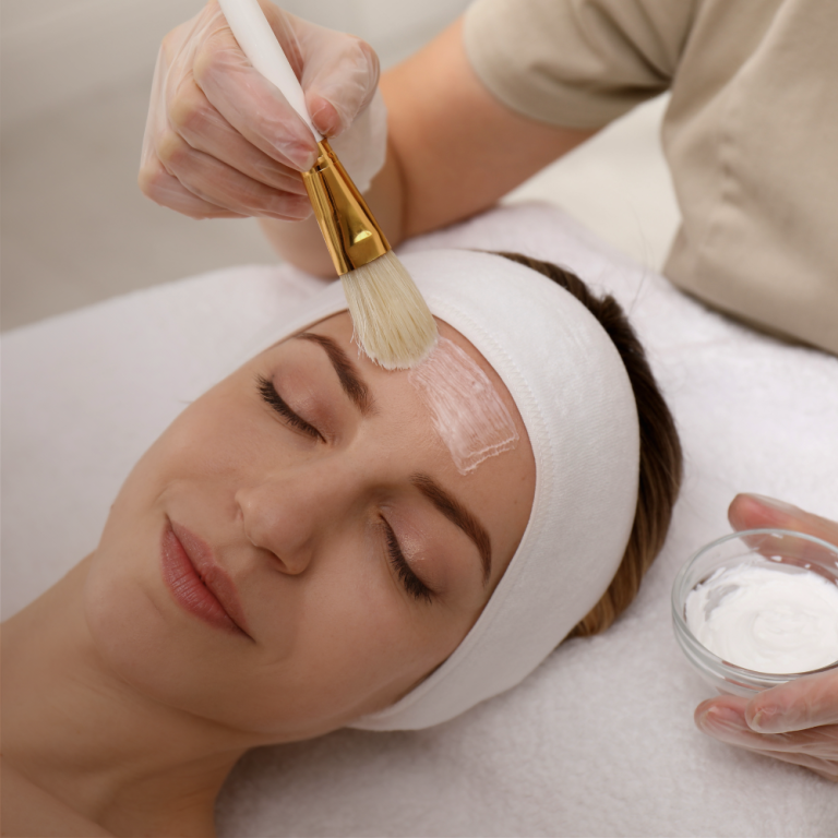 chemical peel picture